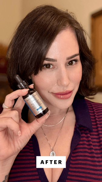 Robin after applying the SkinCeuticals PTiox